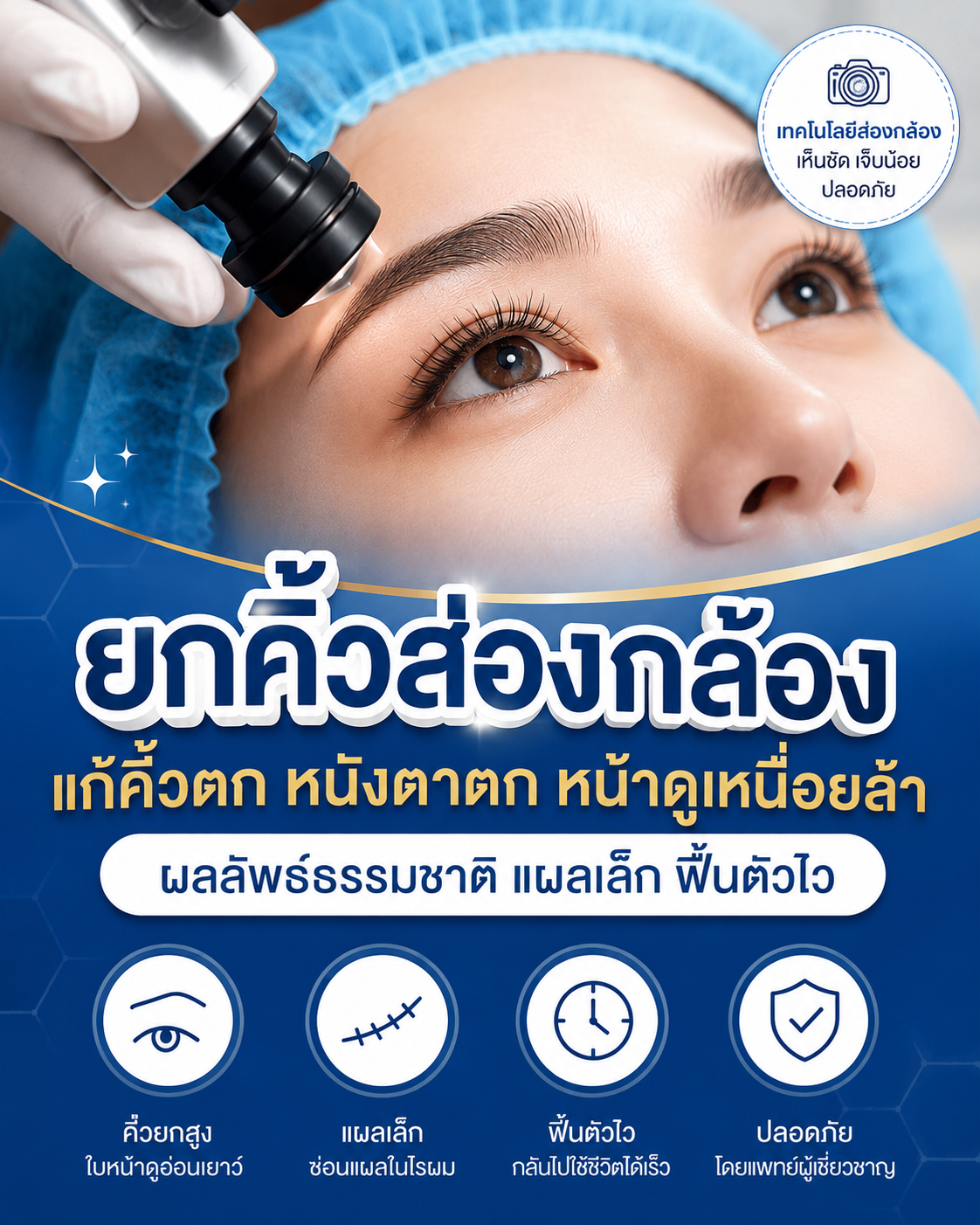 ส่องกล้องยกคิ้ว
