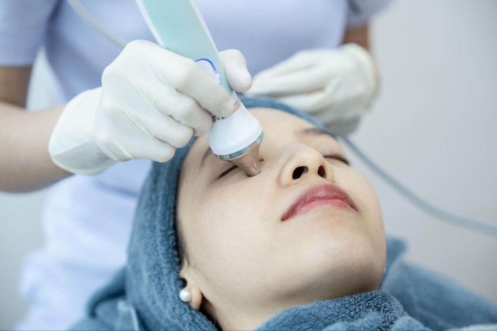 morpheus 8 ราคา