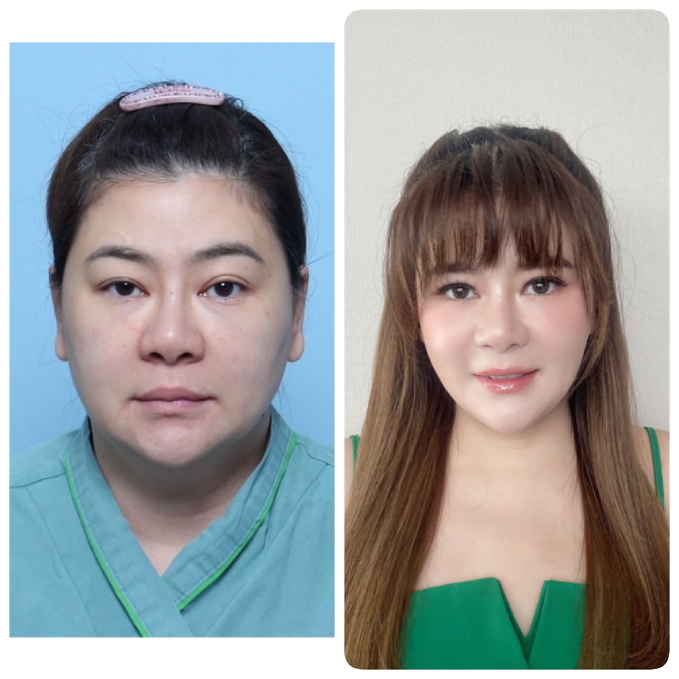 491901969 18505723978011540 2955851491615630210 n