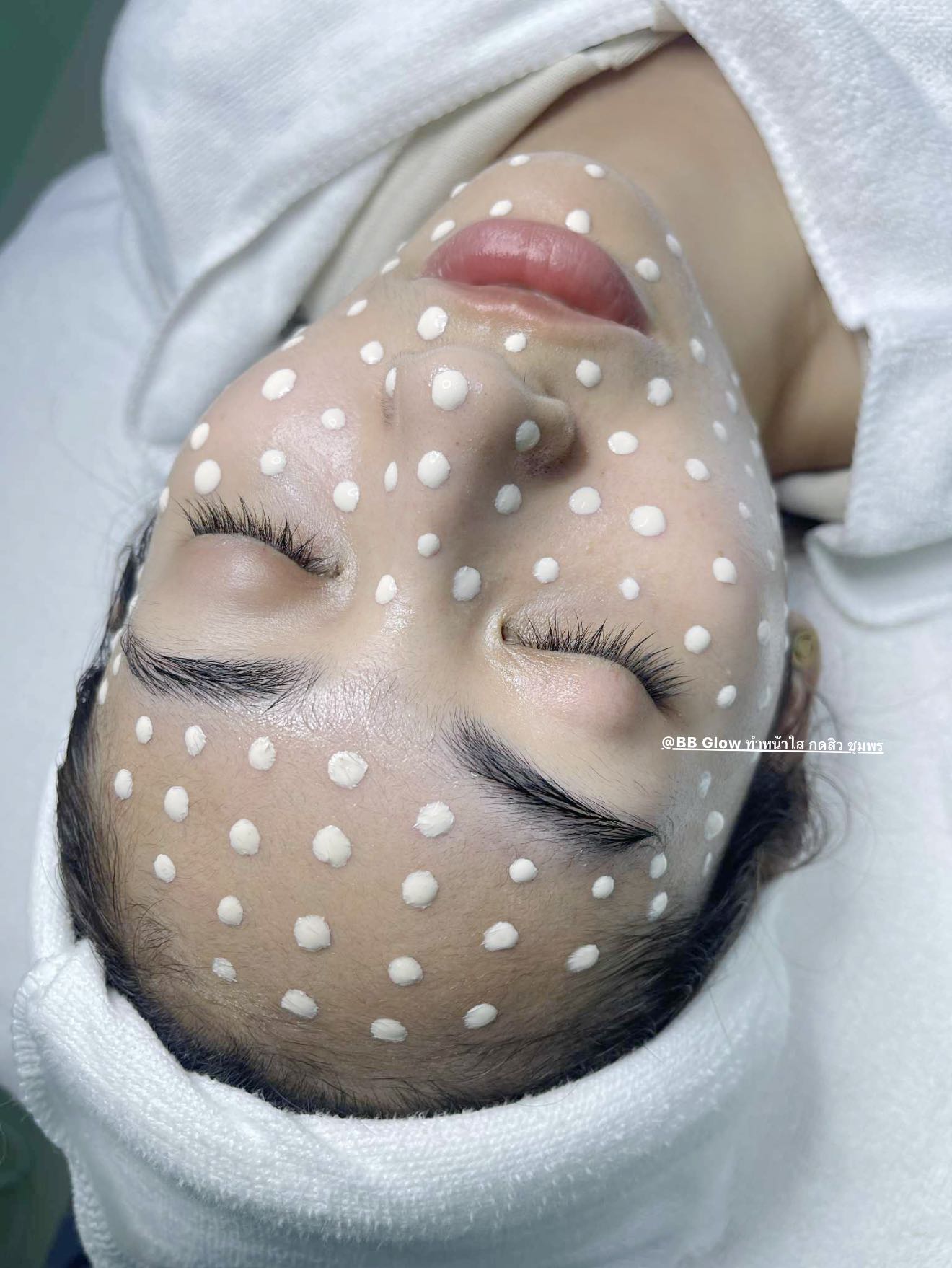 ผลงาน BB Glow รีวิวลูกค้าจริง ชุมพร