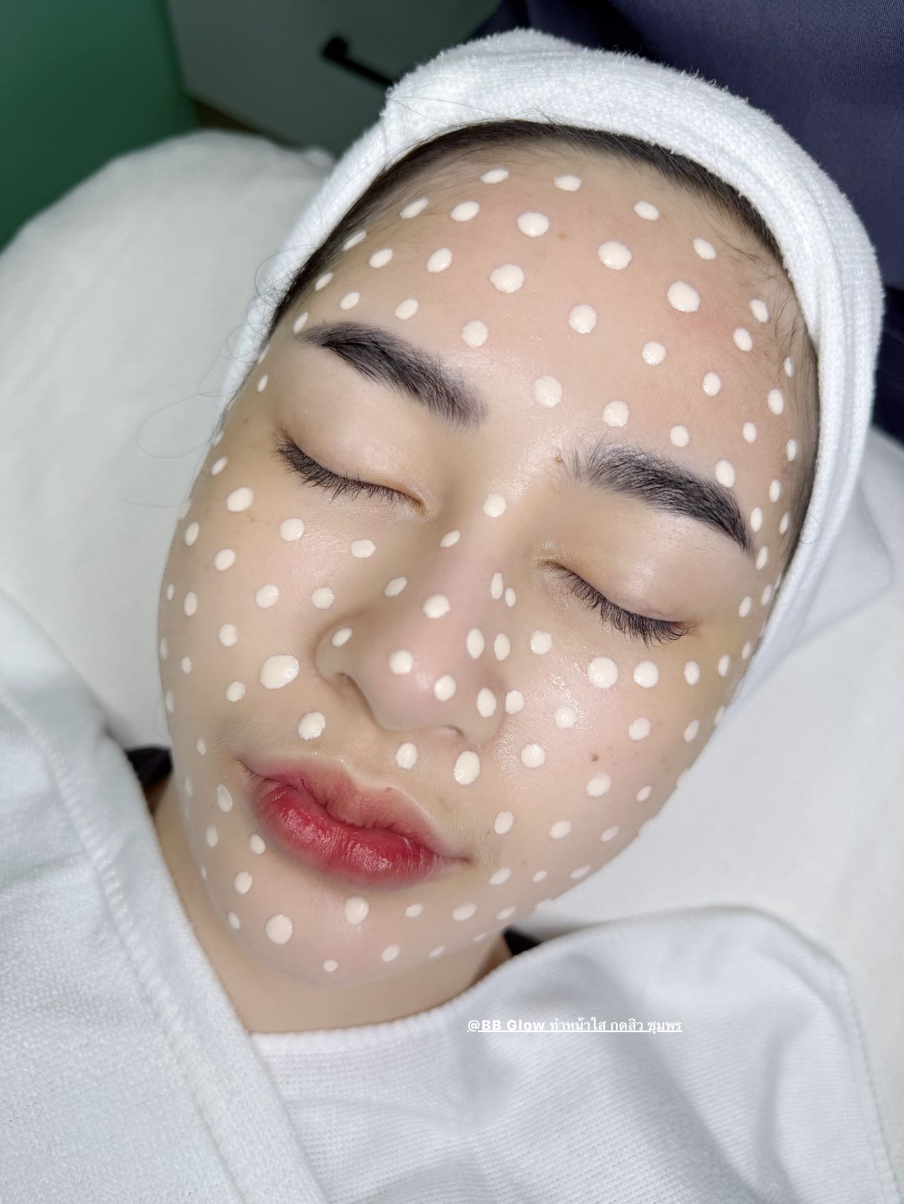 ทรีตเมนต์ฟื้นฟูผิว หน้าใส ชุมพร