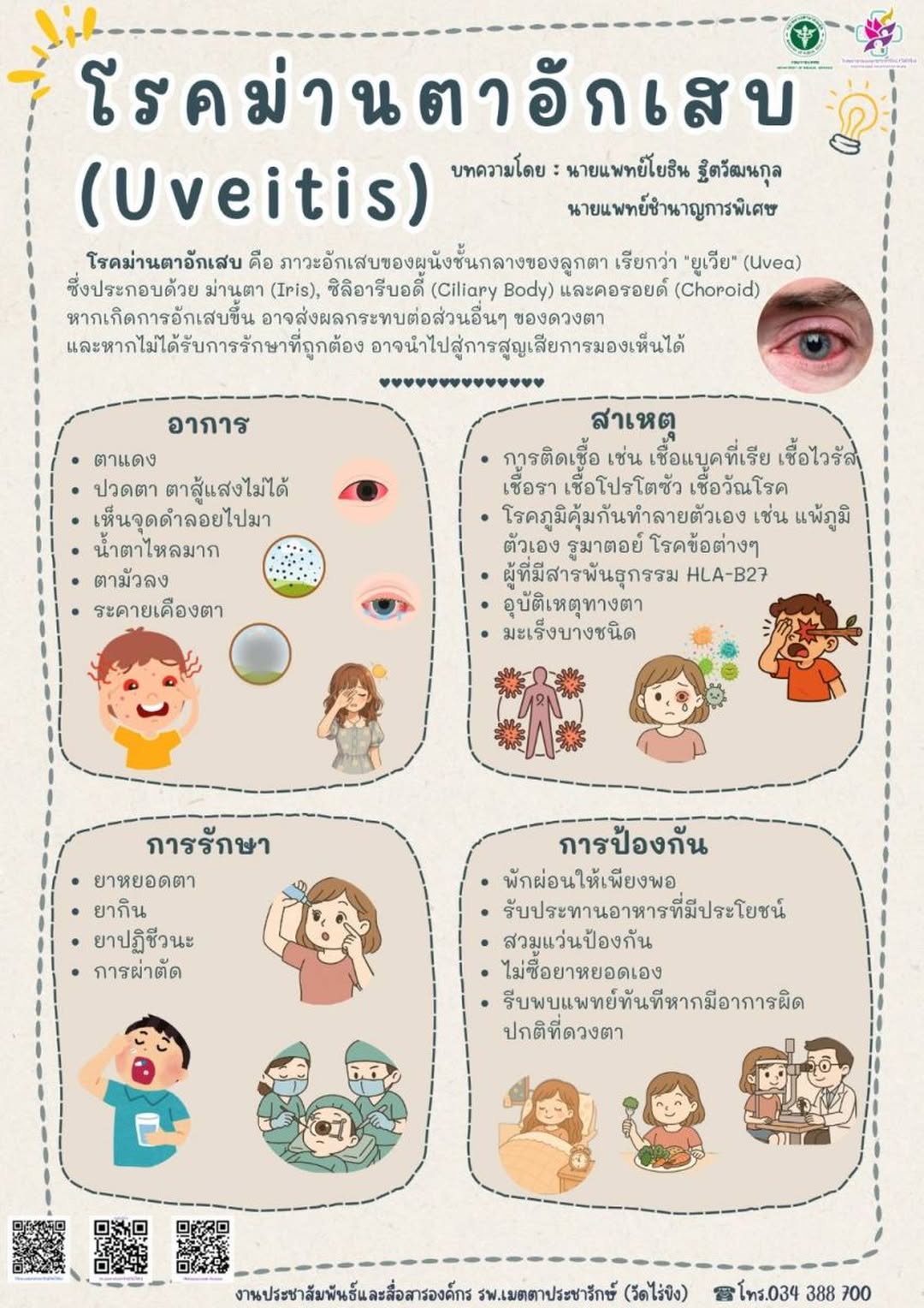 ม่านตาอักเสบ