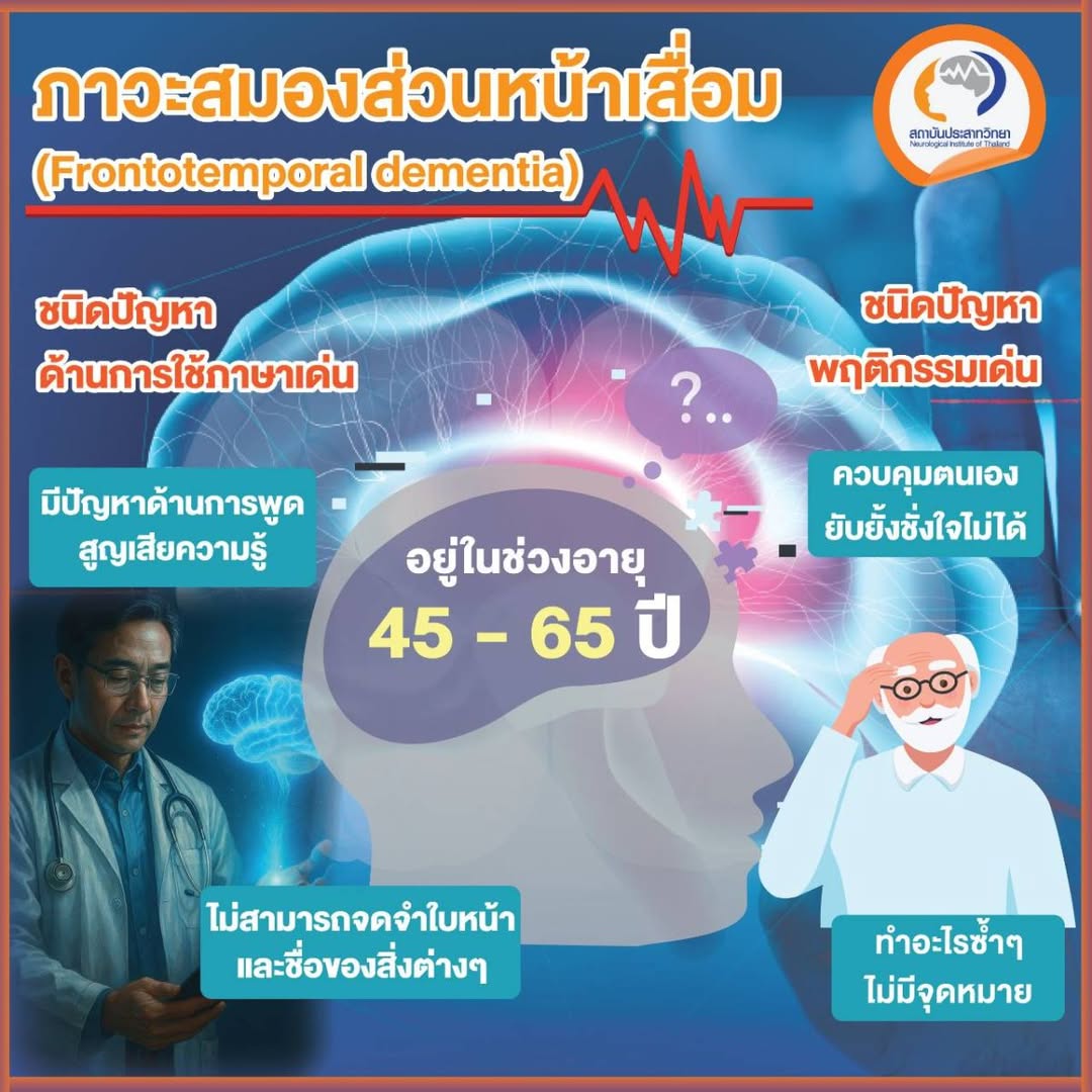 สมองส่วนหน้าเสื่อม