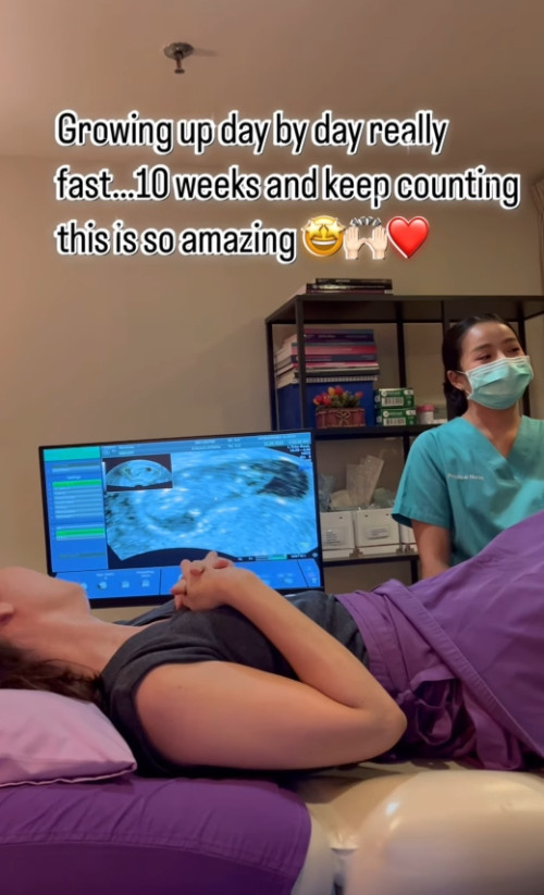 gal 9800666 20250609065535 90503f9