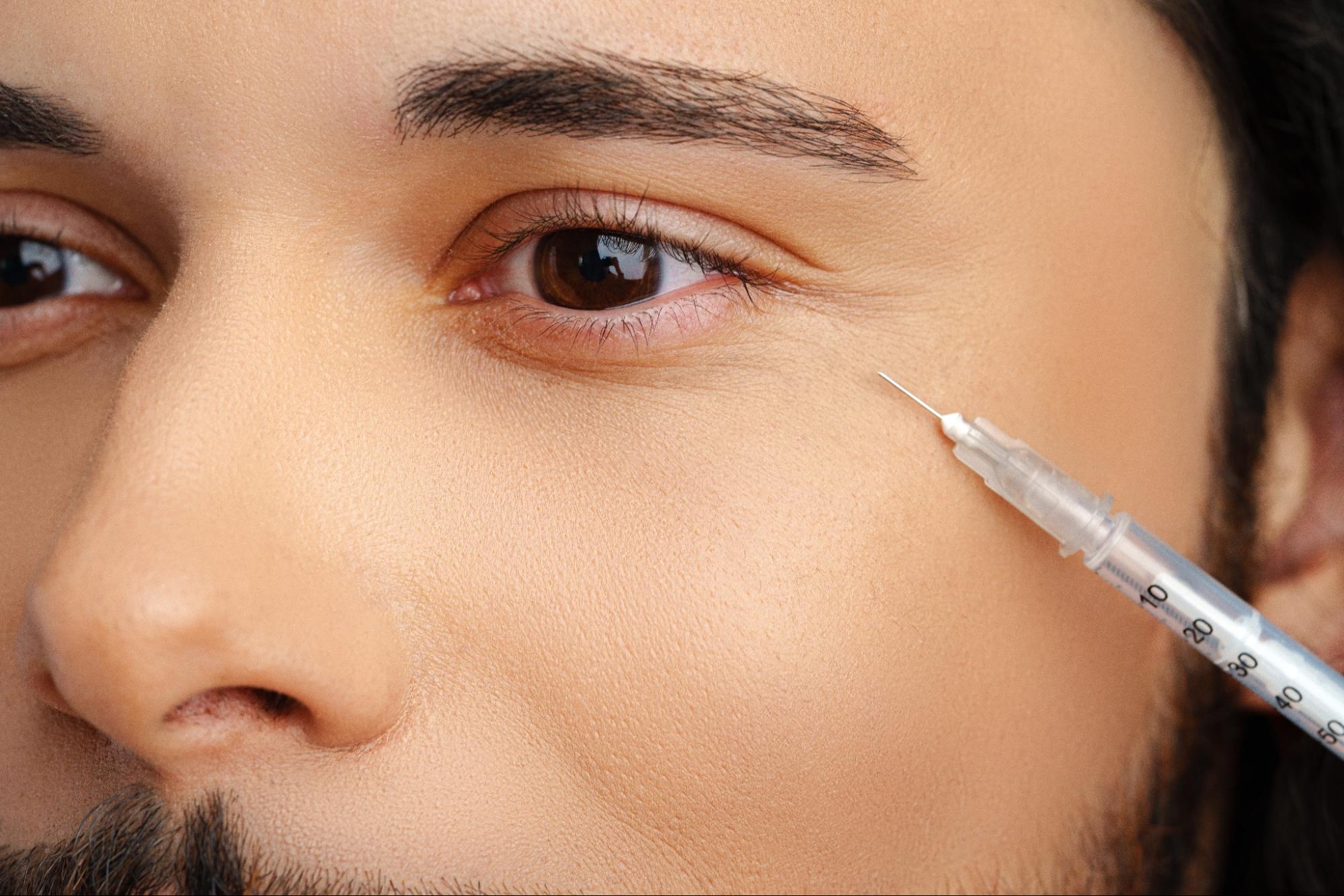 ฉีดฟิลเลอร์ใต้ตา