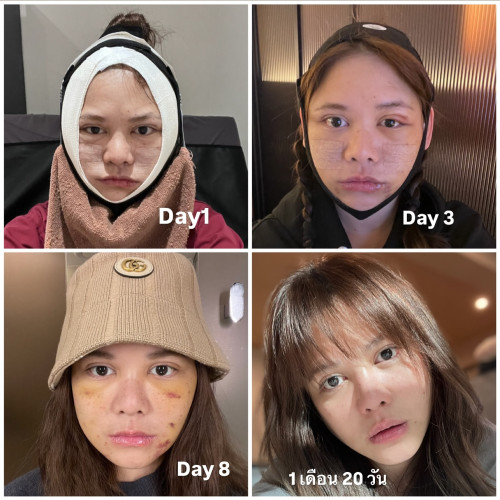 pimmada 1747801396302