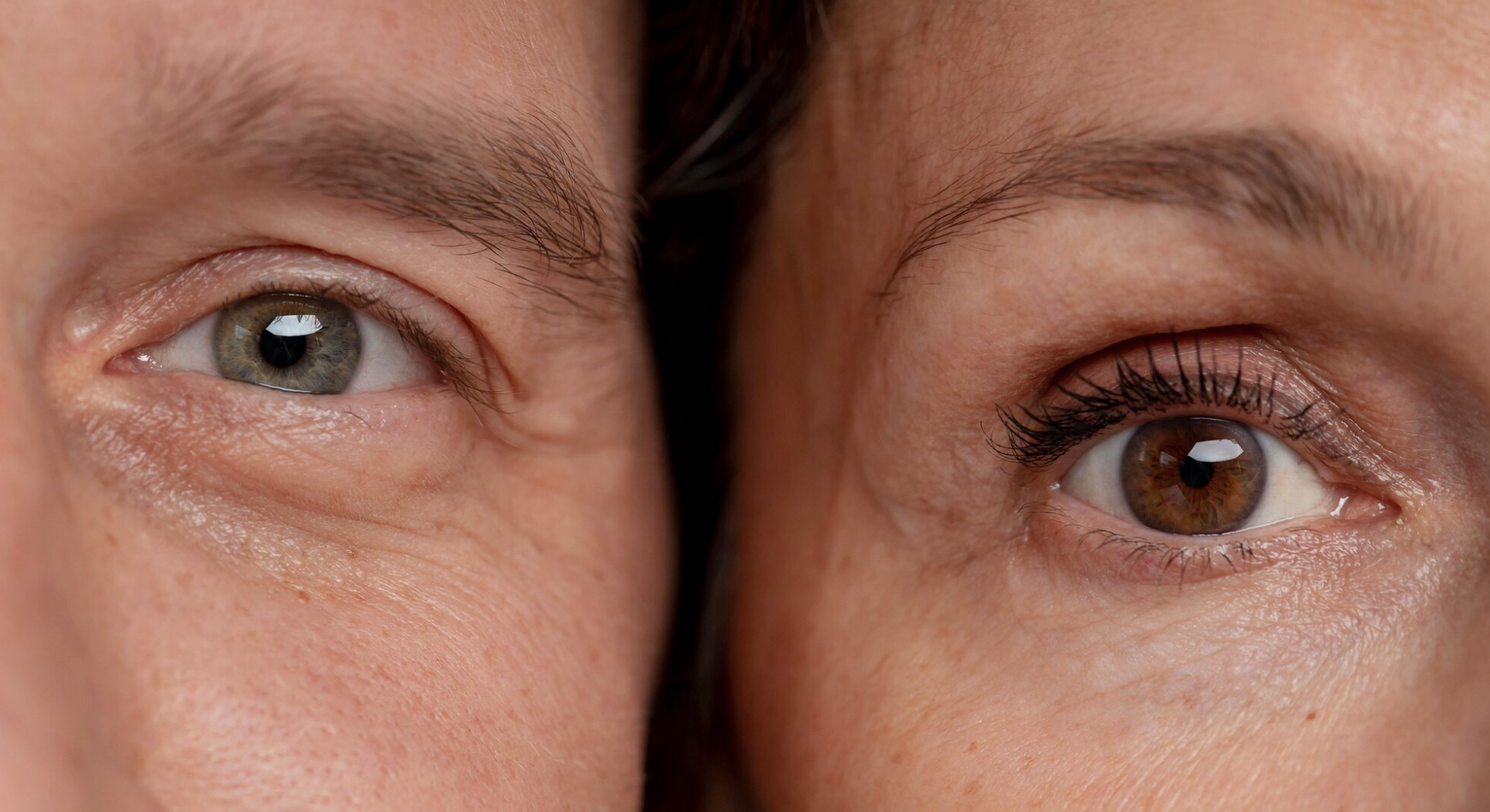 กล้ามเนื้อตาอ่อนแรง