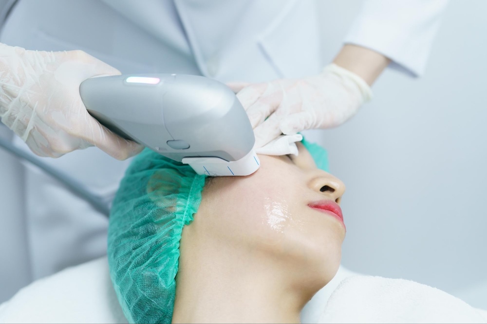 ข้อควรระวัง ultraformer iii